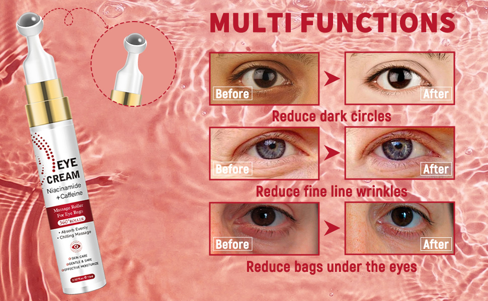 eye bags treatment for men;eye bags treatment for women;