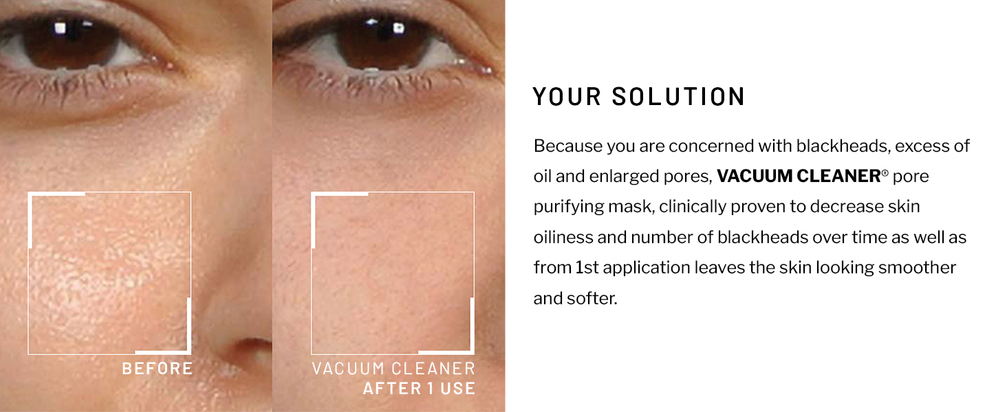 minimized liquid exfoliating powder needle spot tightening dark correcting makeup brush exfoliator