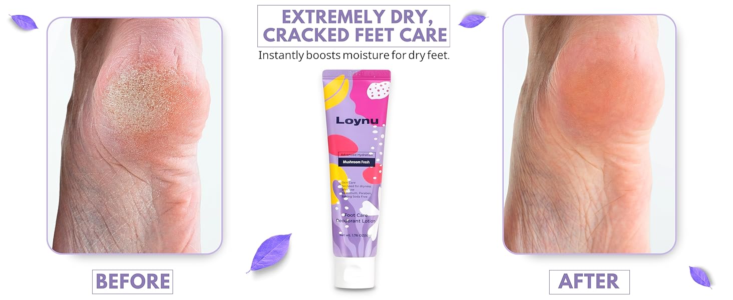 foot deodorant lotion