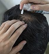 Mann beim Auftragen des Panthrix Haarwuchsmittel 