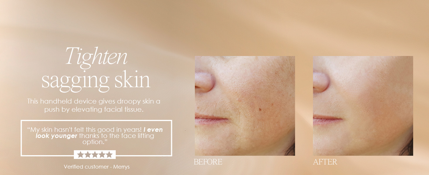 vibrations LED light therapy anti-blemish anti-aging reduce wrinkles collagen boost tightens