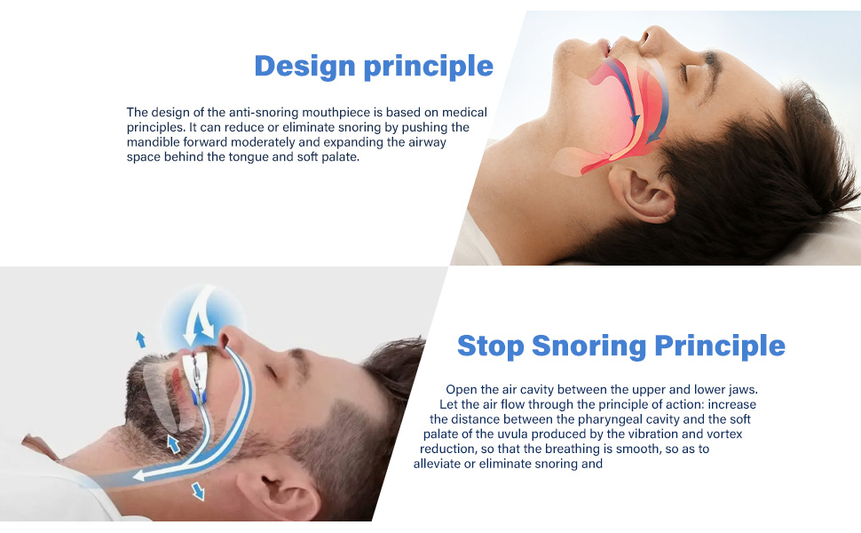 Anti Snoring Device