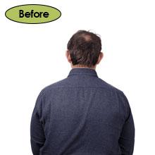 Hairboost Shampoo Before