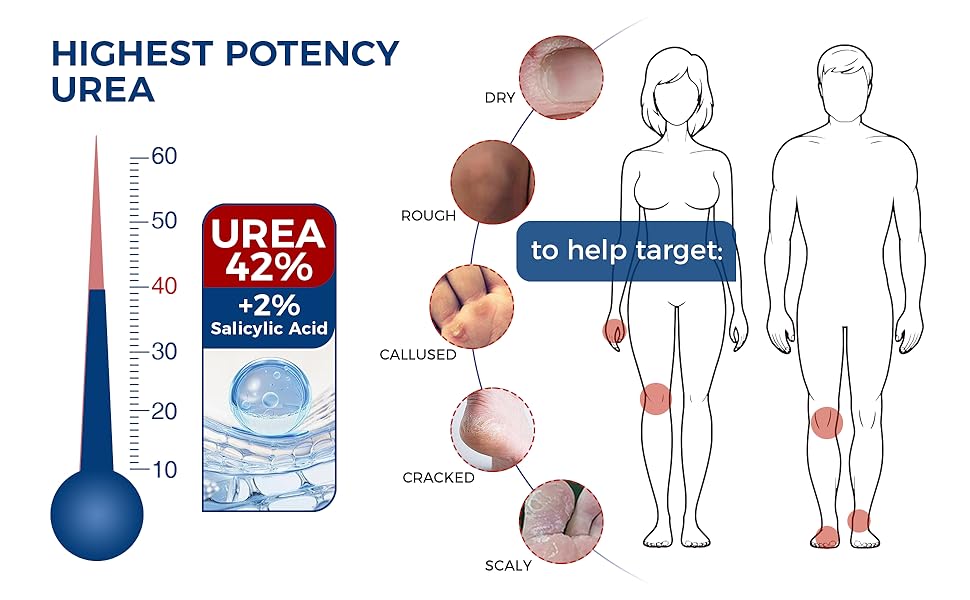 HICHEST POTENCY UREA