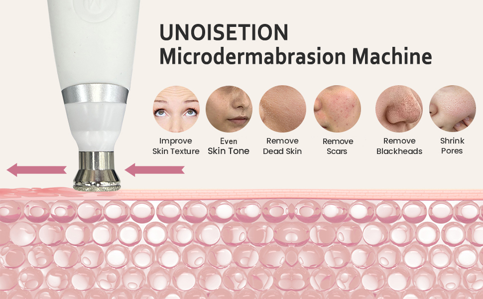 microdermabrasion machine