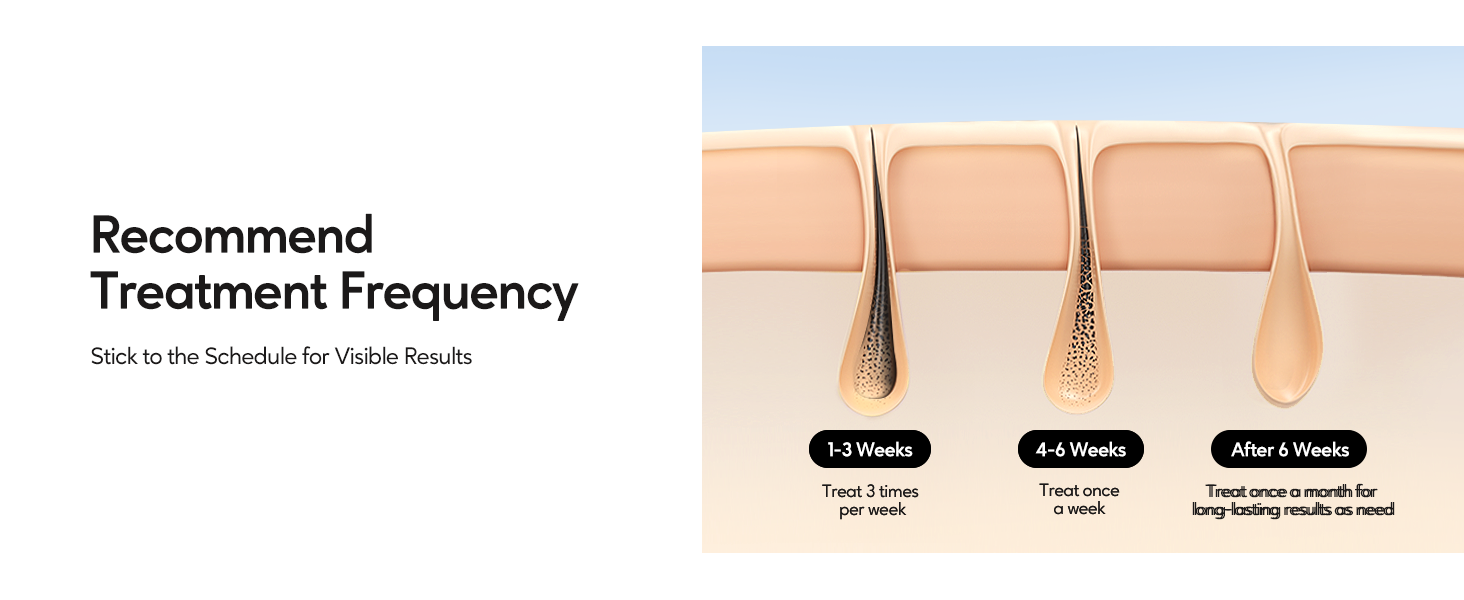 Recommend Treatment Frequency