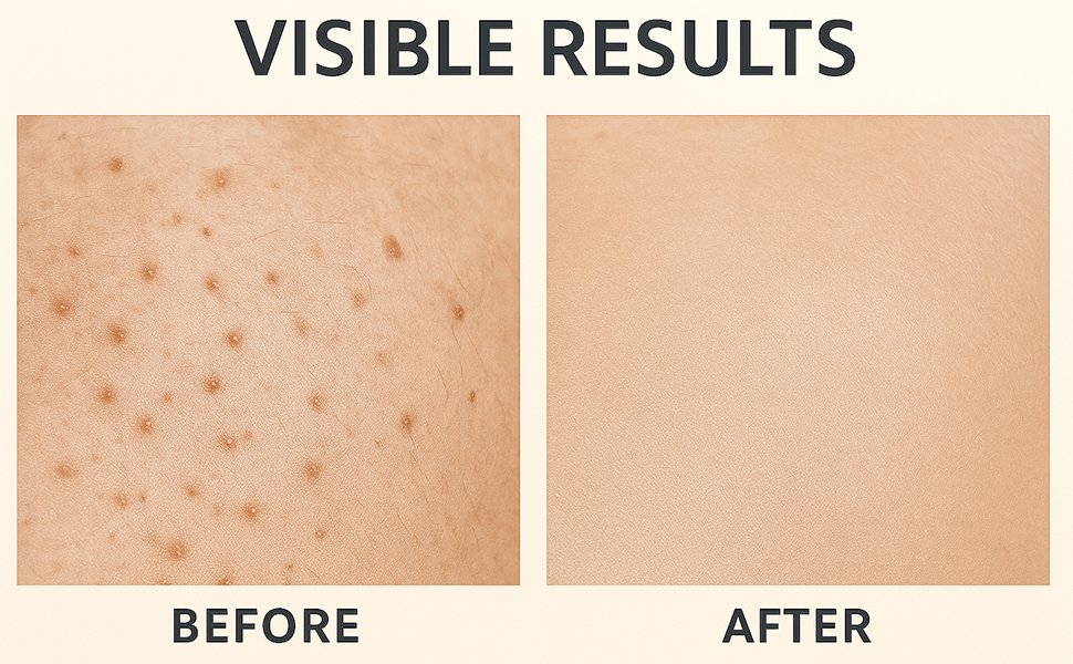 razor bump treatment smoothing solution ingrown hair cyst removal in grown hair treatment