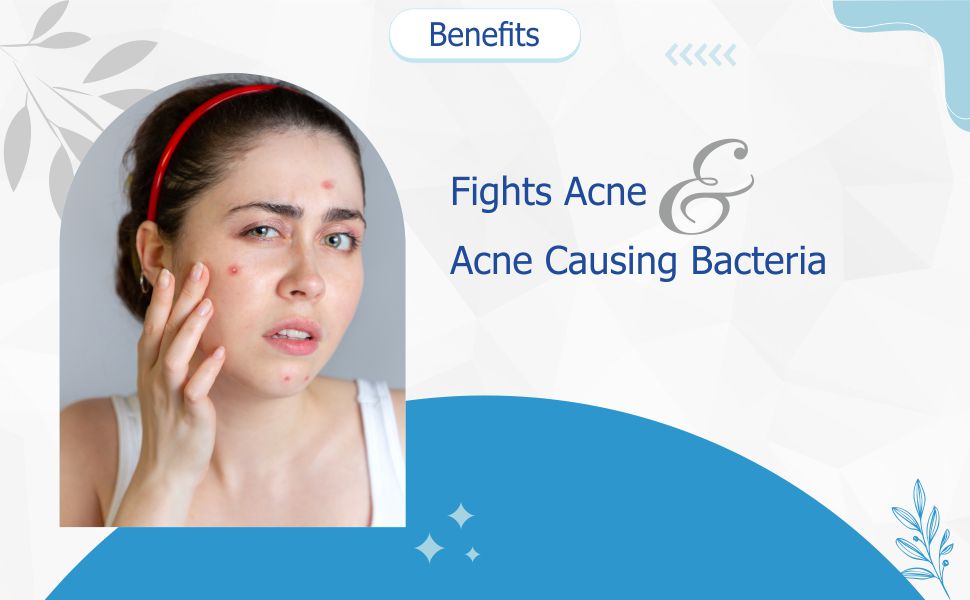 Buy Anti Acne Soap Enriched with Allantoin, Vitamin E & Aloe