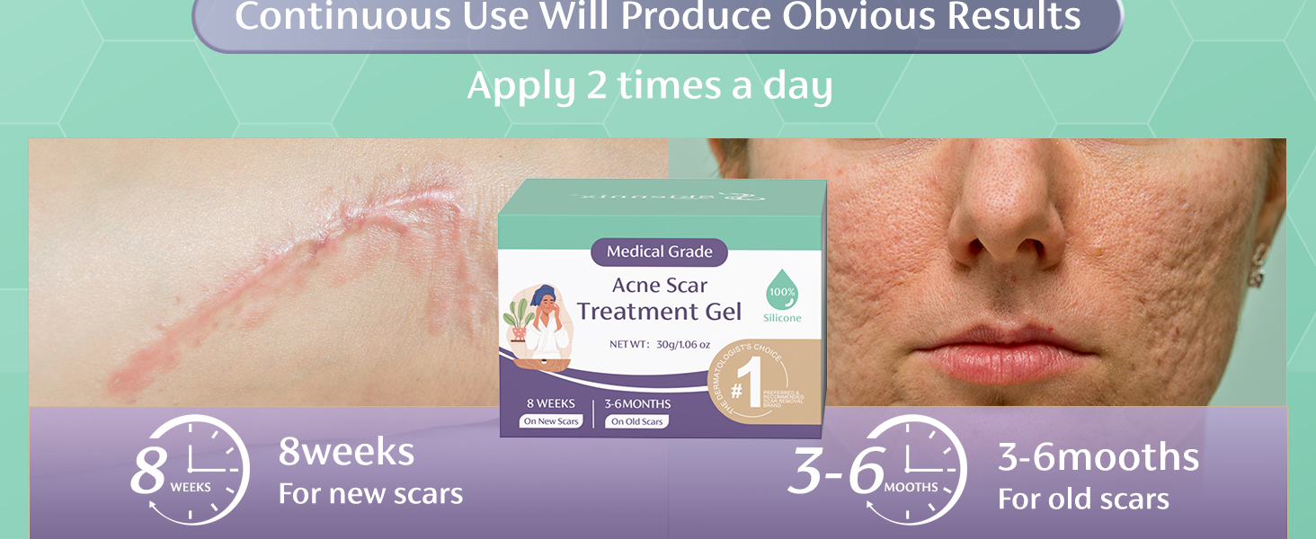 for Face Acne, Surgical, Injury, Burns for Face & Body