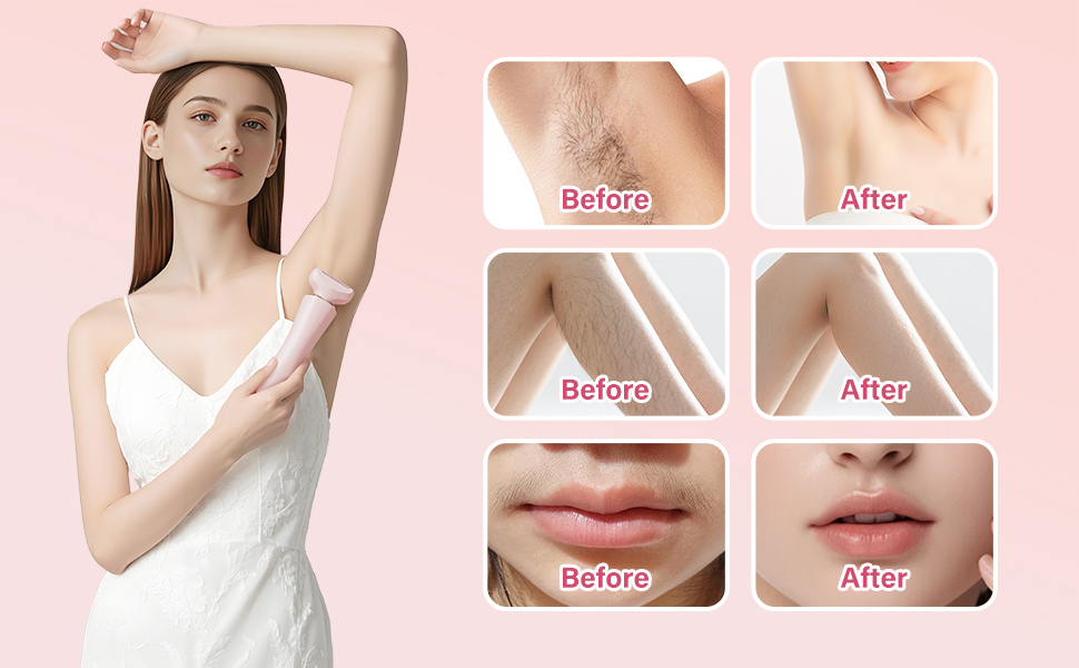 epilators hair removal for women