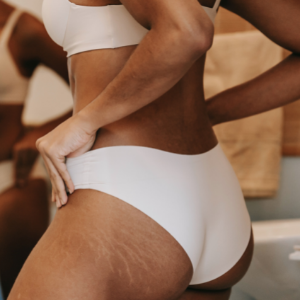 body scrub, cellulite, stretch marks