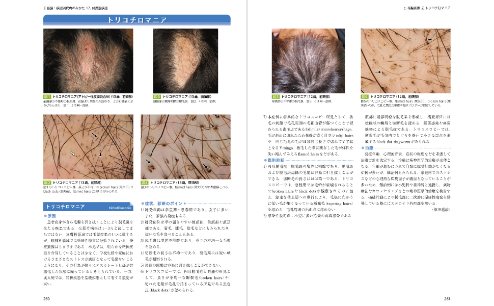 小児皮膚病アトラス | 吉田和恵 |本 | 通販 | Amazon