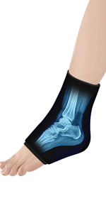 Ankle Ice Pack Wrap