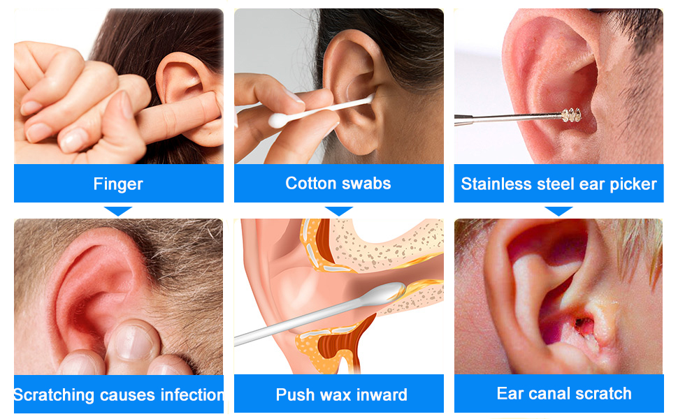 Hoelg Ear Wax Removal Kit Camera Otoscope Ear Cleaner Camera Ear Camera