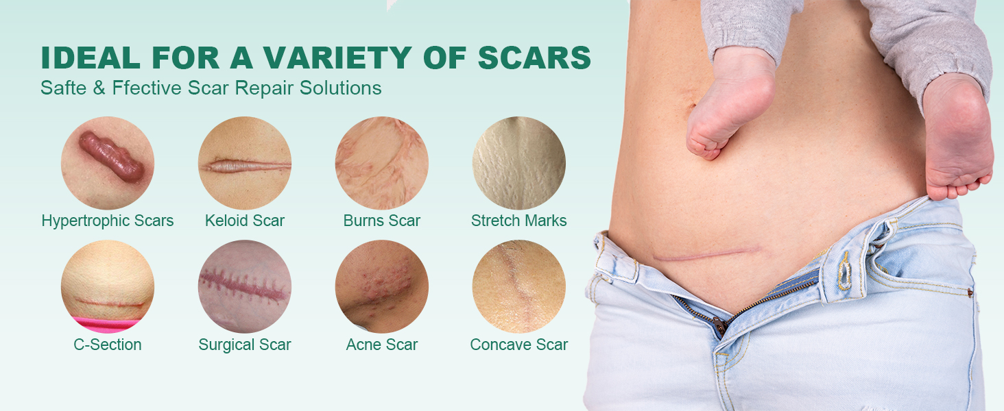 Scar Removal Treatment