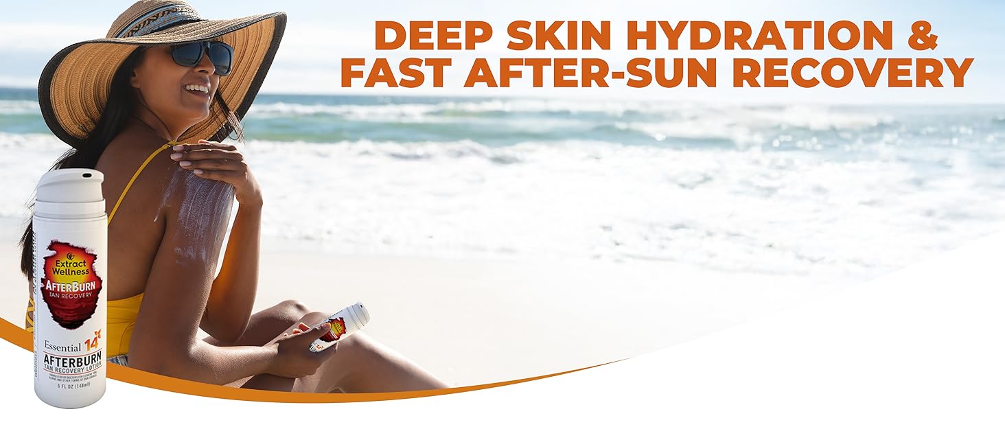 AfterBurn Recovery Lotion