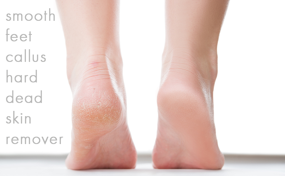smooth feet callus hard dead skin remover