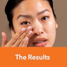 DRx Blemish Solutions Acne Eliminating Gel