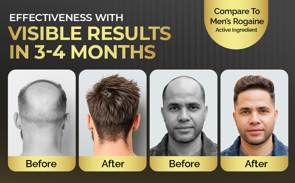 rogan hair growth men minoxidil oil for men