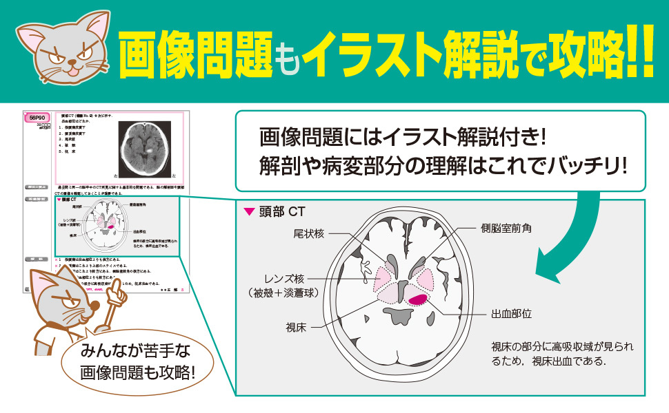 クエスチョン・バンク 理学療法士・作業療法士国家試験問題解説 2022 クエスチョン・バンク 作業療法士 国家試験問題解説 2022 専門
