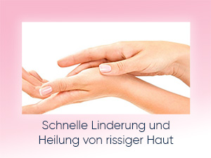  Herome Kur für Rissige Haut (Cure For Chapped Skin)