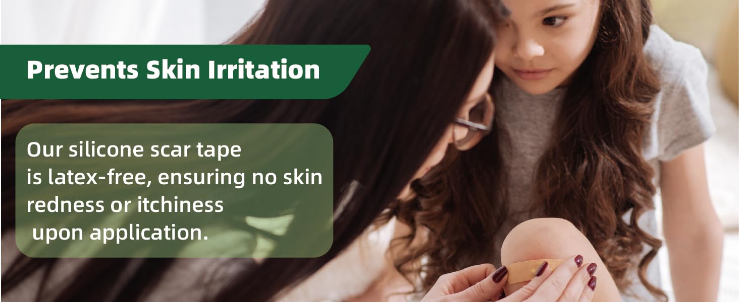 Silicone Scar Sheets