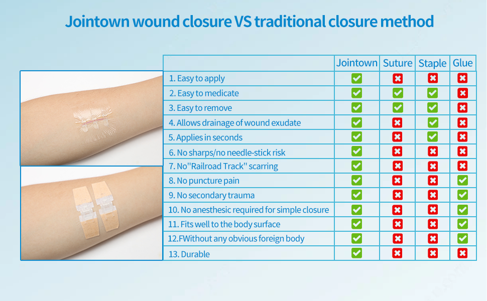 wound closure