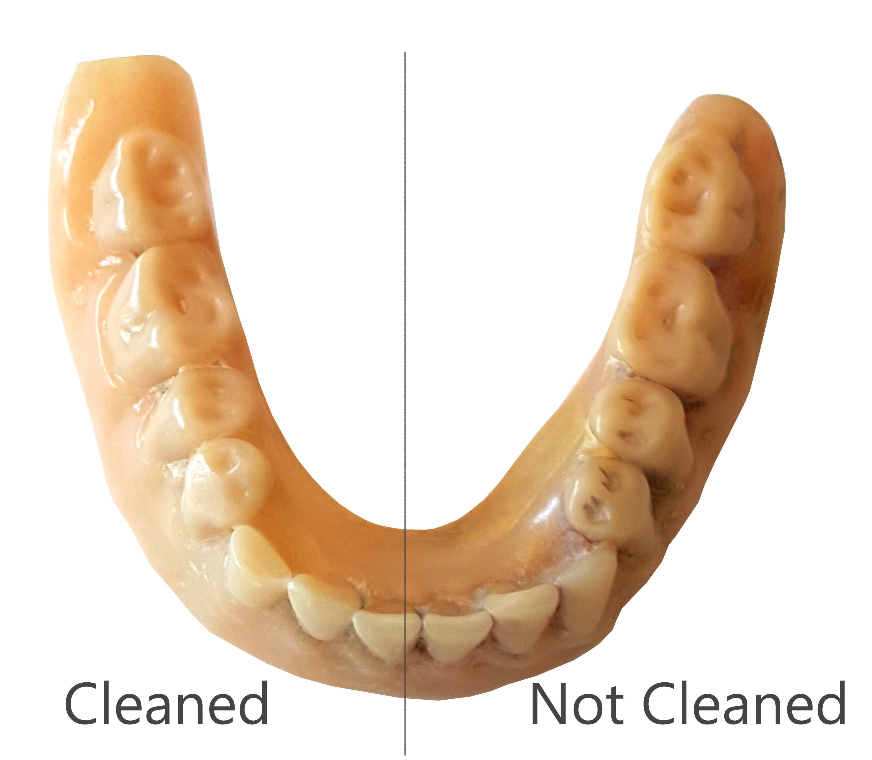 iSonic F3900 Ultrasonic Cleaner for Dentures, Aligners