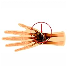 Scaphoid fractures ,Irufa,thumb,wrist,splint,brace,wrap,support,spica,stabilizer,breathable