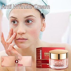 Skin tightening