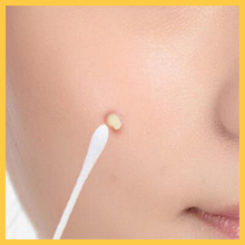 blackheads remover