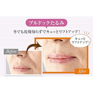 Amazon ヴァーナル リフトアイセラム 15g アイクリーム 目もとケア シワ ハリ たるみ リフトアップ ヒアルロン酸 コラーゲン エラスチン 配合 ヴァーナル 美容液 通販