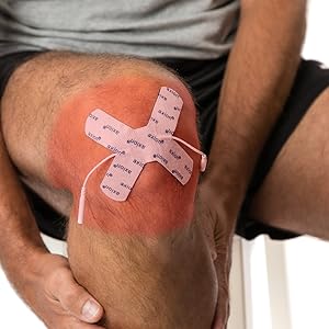 Knie