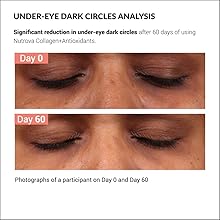 Clinical study result dark circles Nutrova Collagen+Antioxidants