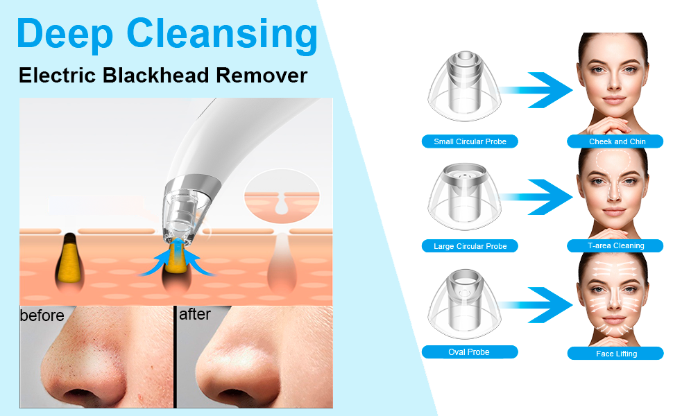 blackhead cleanning tool