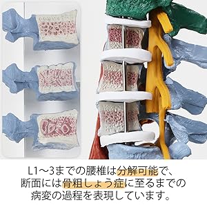 Amazon.co.jp: 7ウェルネ 脊椎模型 人体模型 (主要筋 靭帯 神経