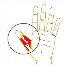 Dislocated Thumb ,Irufa,thumb,wrist,splint,brace,wrap,support,spica,stabilizer,breathable