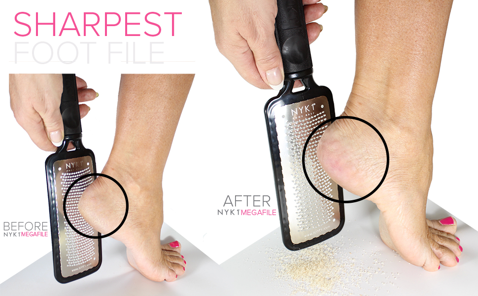 Ultimate Foot File Hard Skin Remover Best Foot Files for Hard Skin
