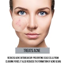 night moisturizer,facial products skin care for women,retinol serum for face,retinol cream 