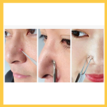 blackhead removal tool