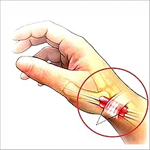 DeQuervains  ,Irufa,thumb,wrist,splint,brace,wrap,support,spica,stabilizer,breathable