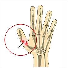 Broken Thumb ,Irufa,thumb,wrist,splint,brace,wrap,support,spica,stabilizer,breathable