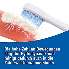 zahnspange zahnzwischenräume implantate zahnersatz prothesen putzen zahn zähneputzen zahnreinigung