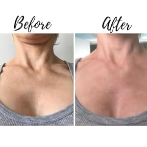 neck pads fine line filler cream decollette patches for fine lines and sun damage scar treatment 