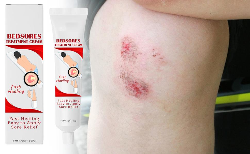 Bedsore Wound Care Cream