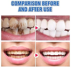 Enhance Teeth Cleaning