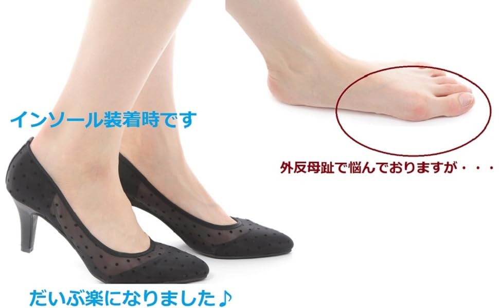 外反母趾でお悩み