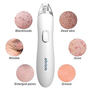 nose blackhead remover