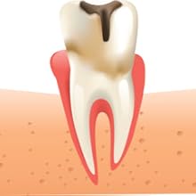mouthwash for tooth pain,best mouthwash,oral care,herbal mouthwash,antiseptic mouthwash