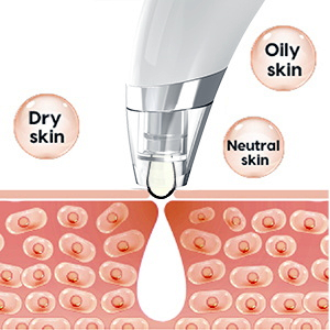 skin vacuum blackhead remover